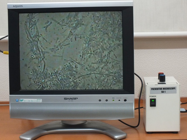 虫歯菌、歯周病菌が見れる顕微鏡
