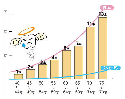 1.なぜ痛くないのに歯医者さんに行くの？